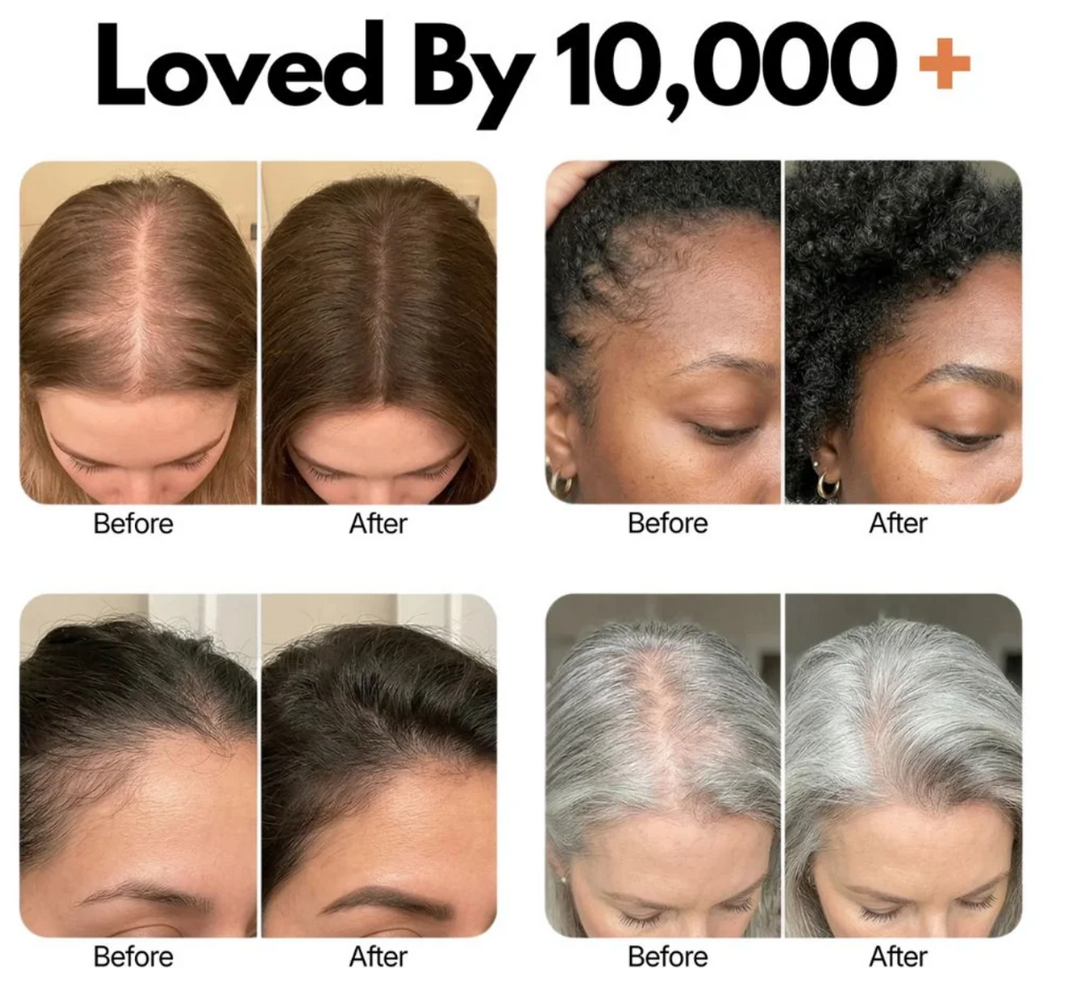 Korea's #1 Hair Growth Serum