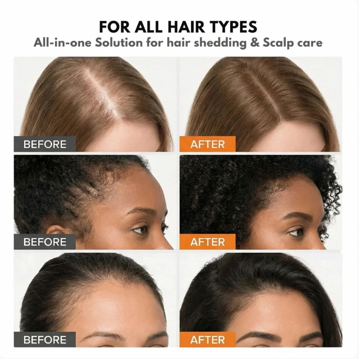 Korea's #1 Hair Growth Serum
