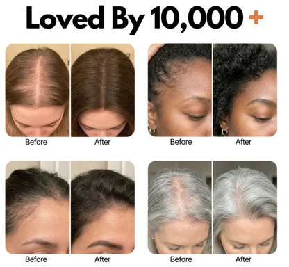 Korea's #1 Hair Growth Serum